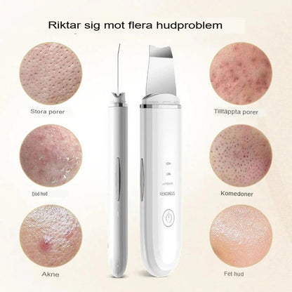 Djuprengörande ultraljuds-peelingapparat Ivea